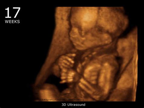 17 Week 3d Ultrasound Baby Picture Pregnancy Symptoms Week By Week