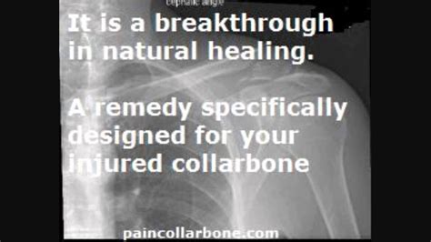 Collarbone Pain Dissolves Fast Youtube
