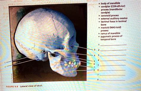 Solved Body Of Mandible Condylar Con Dih Lar Process Mandibular