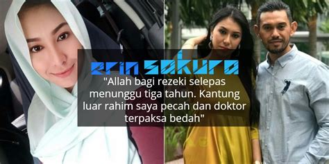 Selain di bagian payudara yang mengalami perubahan warna kulit, seorang perempuan yang mengalami awal kehamilan juga akan menjumpai perbedaan warna kulit pada daerah wajah, leher, dan dinding perut. "Hamil Kembar Tiga, Dua Berada Di Luar Rahim" - Pelakon ...