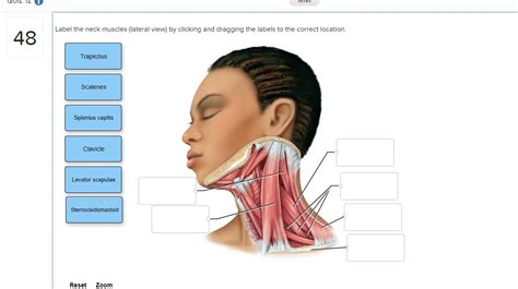 Solved Seved Label The Neck Muscles Lateral View By