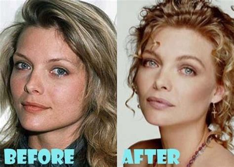 Michelle Pfeiffer Before And After Plastic Surgery 30 Celebrity