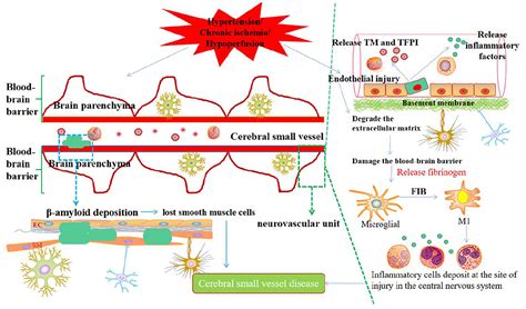 Frontiers Cerebral Small Vessel Disease Neuroimaging Features