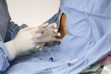 Como a anestesia regional é usada durante a cirurgia Conselho Médico