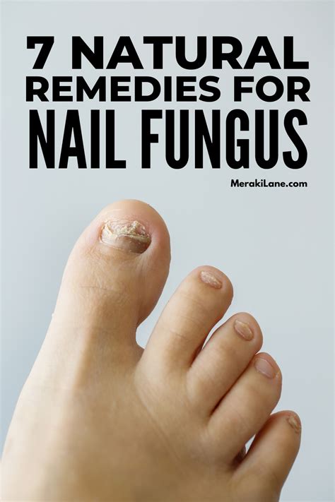 7 Home Remedies For Nail Fungus That Work