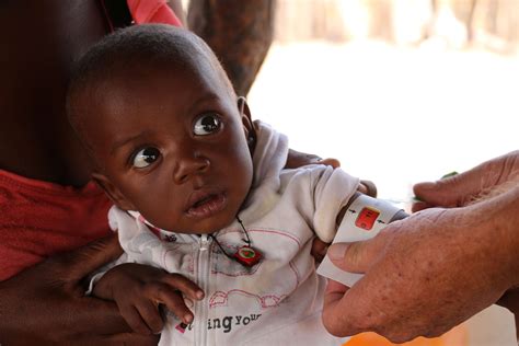 Baby Beto Bounces Back From Severe Malnutrition World Vision