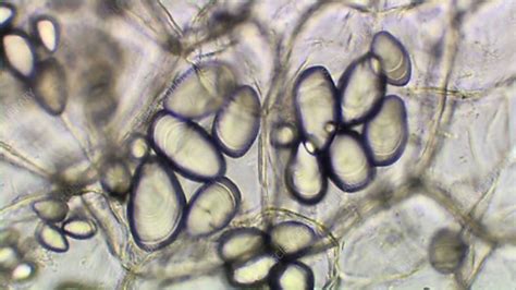 Potato Starch Under Microscope