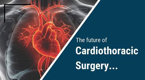 The Basics About Cardiothoracic Surgery