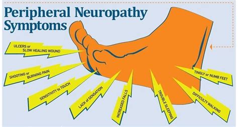 Pin On Neuropathy Symptoms