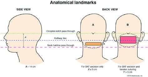 Anatomical Landmarks Side And Back Views Of The Head Showing