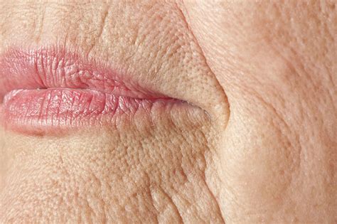 The 10 Most Common Signs Of Aging Skin And How To Reverse Them