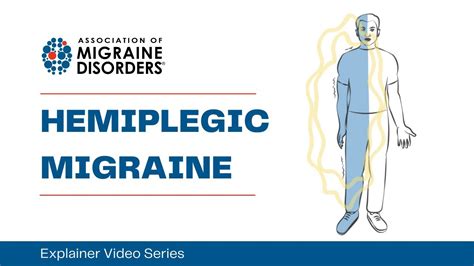 What Is Hemiplegic Migraine Chapter 1 Migraine Types Explainer
