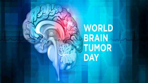 World Brain Tumor Day 2020 What Is Brain Tumor Types Symptoms