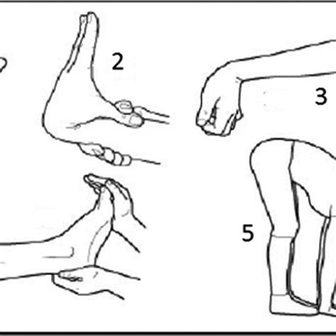 Skin Hyperextensibility And Generalized Joint Hypermobility On Physical