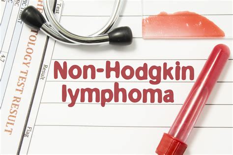 Non Hodgkin Lymphoma Silicosis Help