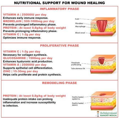 โภชนาการและการหายของแผล Nutrition Guidelines to Improve Wound Healing ...