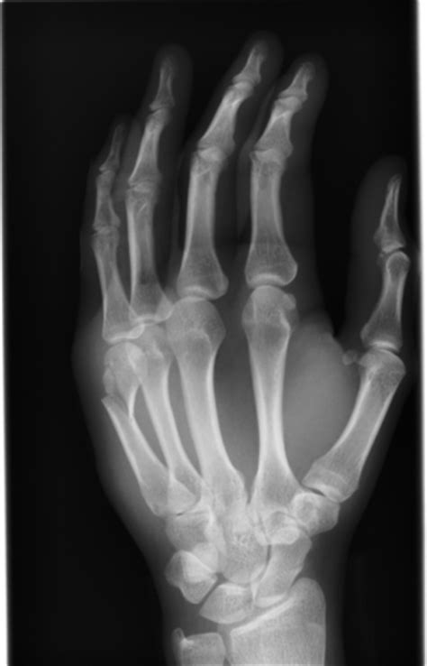 How To Take X Rays ~ Radiographic Imaging