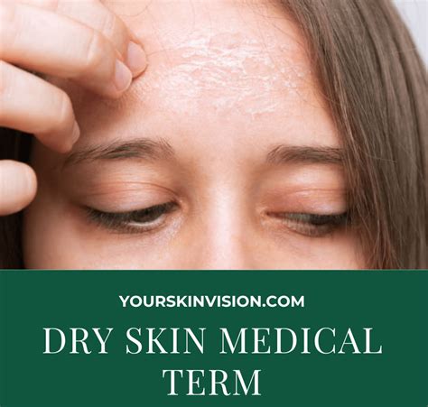 Dry Skin Medical Term Symptoms Causes And Treatment