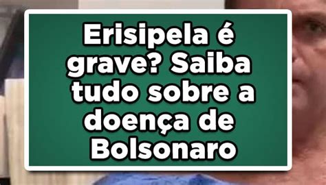 Erisipela é Grave Saiba Tudo Sobre A Doença De Bolsonaro