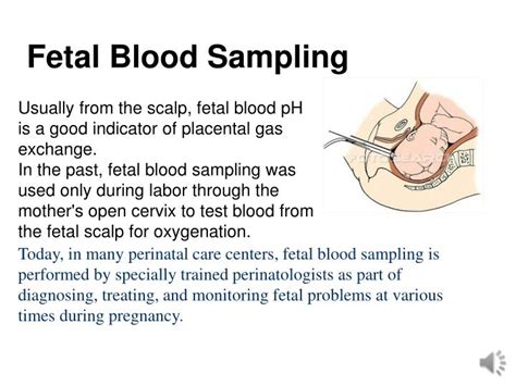 PPT - Fetal Monitoring PowerPoint Presentation - ID:1898600