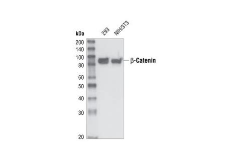 Catenin Antibody Amino Terminal Antigen Cell Signaling Technology