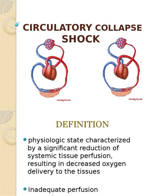 Shock Shock Circulatory Sepsis