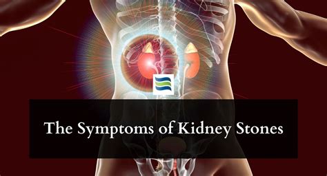 The Symptoms Of Kidney Stones Urology South Bend