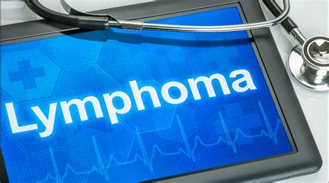 what is lymphoma hodgkin s lymphoma vs non hodgkin s video and lesson transcript