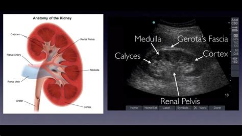 Kidney Anatomy Ultrasound Images Kidney Failure Disease