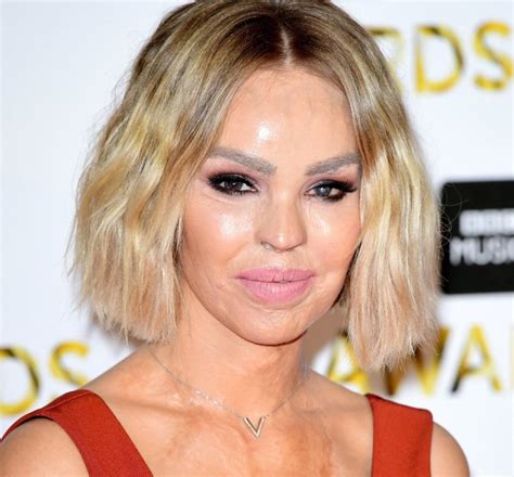 Katie Piper Reveals How She Coped After Acid Attack Metro News