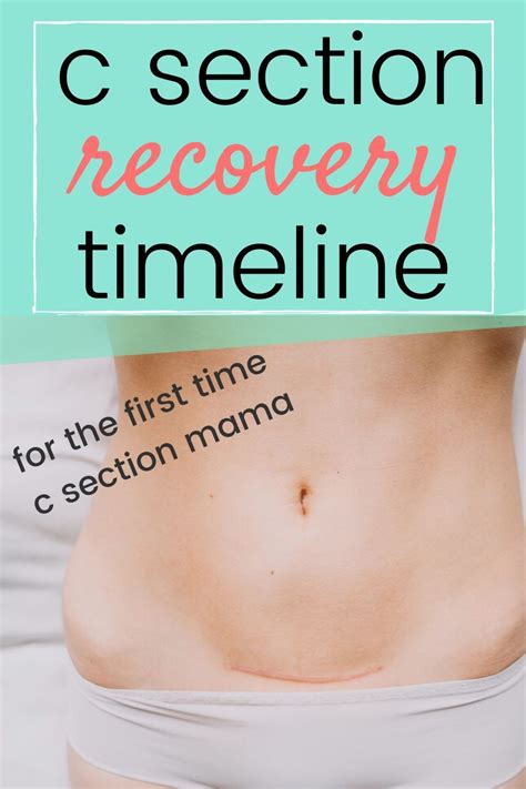 C Section Recovery Timeline A Week By Week Look At Recovery Forgotten Lattes C Section