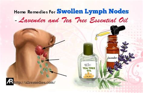 Doterra Oils For Infamed Lymph Nodes In The Groin Manage Non Hodgkin