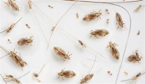 Head Lice Everything You Need To Know As Kids Go Back To School