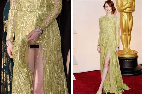 Oscars Emma Stone Flashes Her Crotch In Oscars Wardrobe