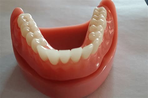 Dentures Mobile Dentistry Of Arizona
