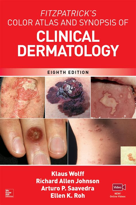 Fitzpatricks Color Atlas And Synopsis Of Clinical Dermatology 8e