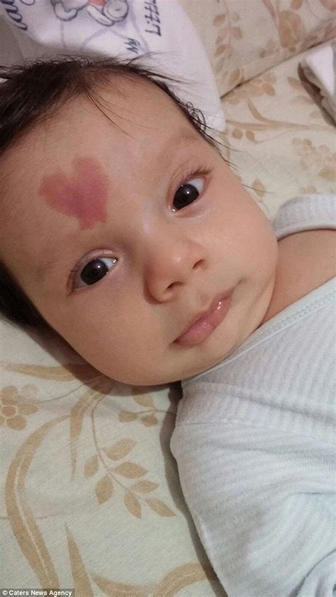 Baby Born With Heart Shaped Birthmark Is Affectionately Known As The