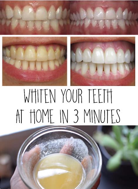 Whiten Your Teeth At Home In 3 Minutes Fashion Accessories And Style