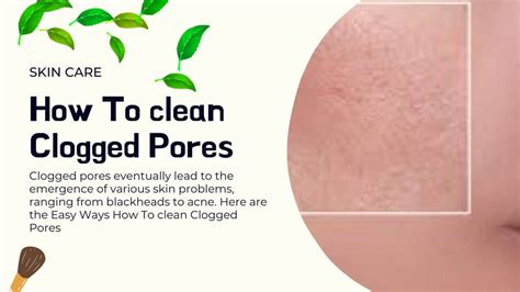 6 Easy Ways How To Clean Clogged Pores 2024
