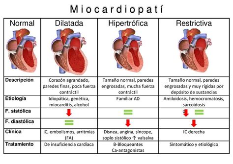Miocardiopatías Milagros Rodriguez uDocz