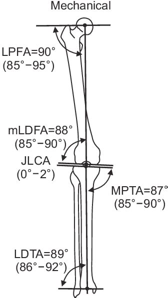Lateral Distal Femoral Angle