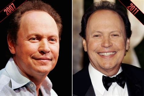 Chatter Busy Billy Crystal Plastic Surgery
