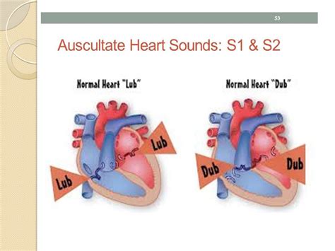 The Heart Sounds презентация онлайн