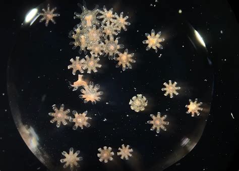Baby Jellyfish Under A Microscope — Arena