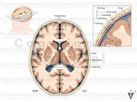 Stock Brain Normal Anatomy — Illustrated Verdict