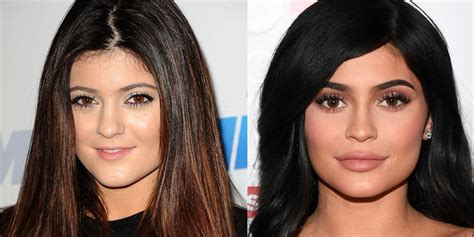 8 artis barat sebelum dan sesudah operasi plastik kylie jenner beda halaman 5