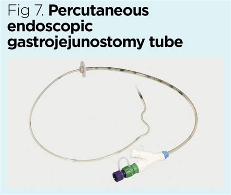 Selection And Management Of Commonly Used Enteral Feeding Tubes