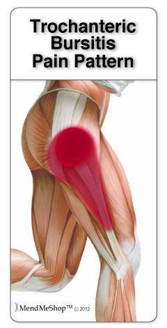 Trochanteric Bursitis Is Often Caused By The Iliotibial Band IT Band Tightening And Rubbing