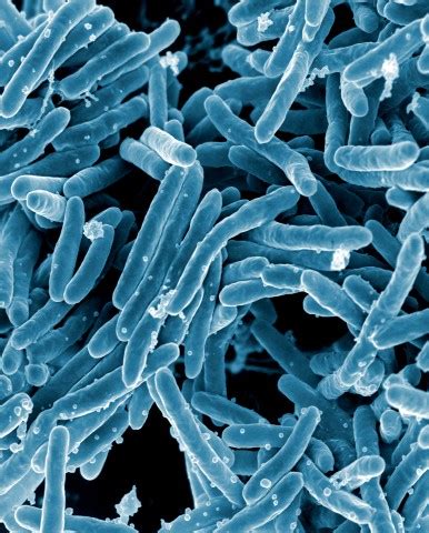 Tuberculosis definition tuberculosis (tb) is a potentially fatal contagious disease that can affect it is caused by a bacterial microorganism, the tubercle bacillus or mycobacterium tuberculosis. Mutation rates of Mycobacterium tuberculosis: From the ...