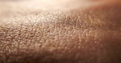 How Diabetes Can Affect Your Skin